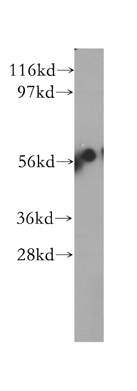 HEK-293 cells were subjected to SDS PAGE followed by western blot with Catalog No:109856(DAK antibody) at dilution of 1:500
