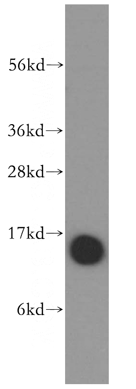 human brain tissue were subjected to SDS PAGE followed by western blot with Catalog No:114214(PFN1 antibody) at dilution of 1:500