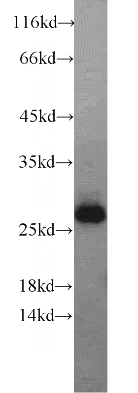 human testis tissue were subjected to SDS PAGE followed by western blot with Catalog No:110942(GMNN antibody) at dilution of 1:300