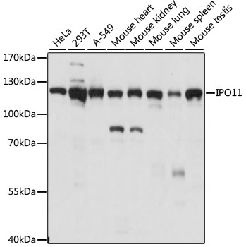 Western blot - IPO11 Polyclonal Antibody 
