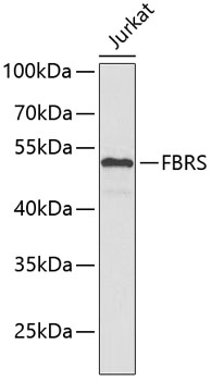 Western blot - FBRS Polyclonal Antibody 