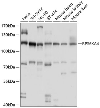 Western blot - RPS6KA4 Polyclonal Antibody 