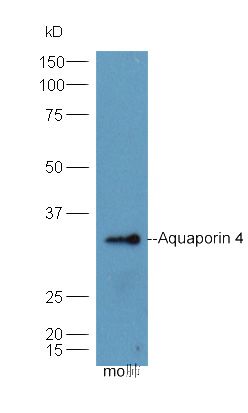 Fig4: Sample: mouse lung lysate at 30ug;; Primary: Anti-Aquaporin 4 at 1:300;; Secondary: HRP conjugated Goat-Anti-rabbit IgG(bse-0295G-HRP) at 1: 5000;; Predicted band size:36 kD; Observed band size:34 kD