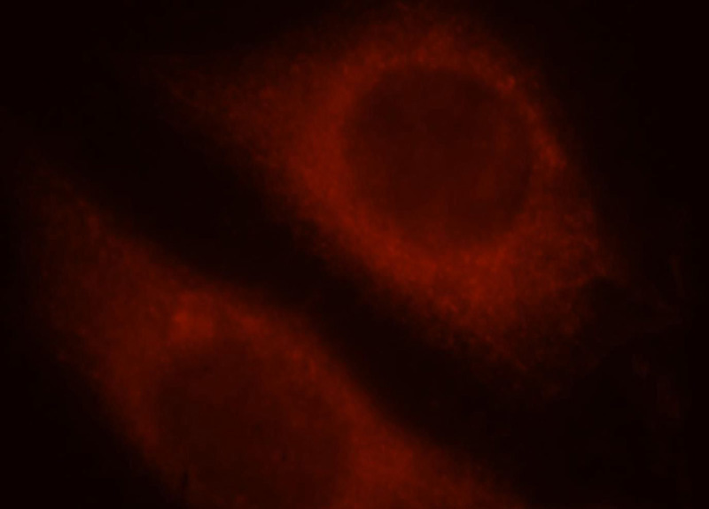 Immunofluorescent analysis of MCF-7 cells, using KRT18 antibody Catalog No:109799 at 1:25 dilution and Rhodamine-labeled goat anti-rabbit IgG (red).