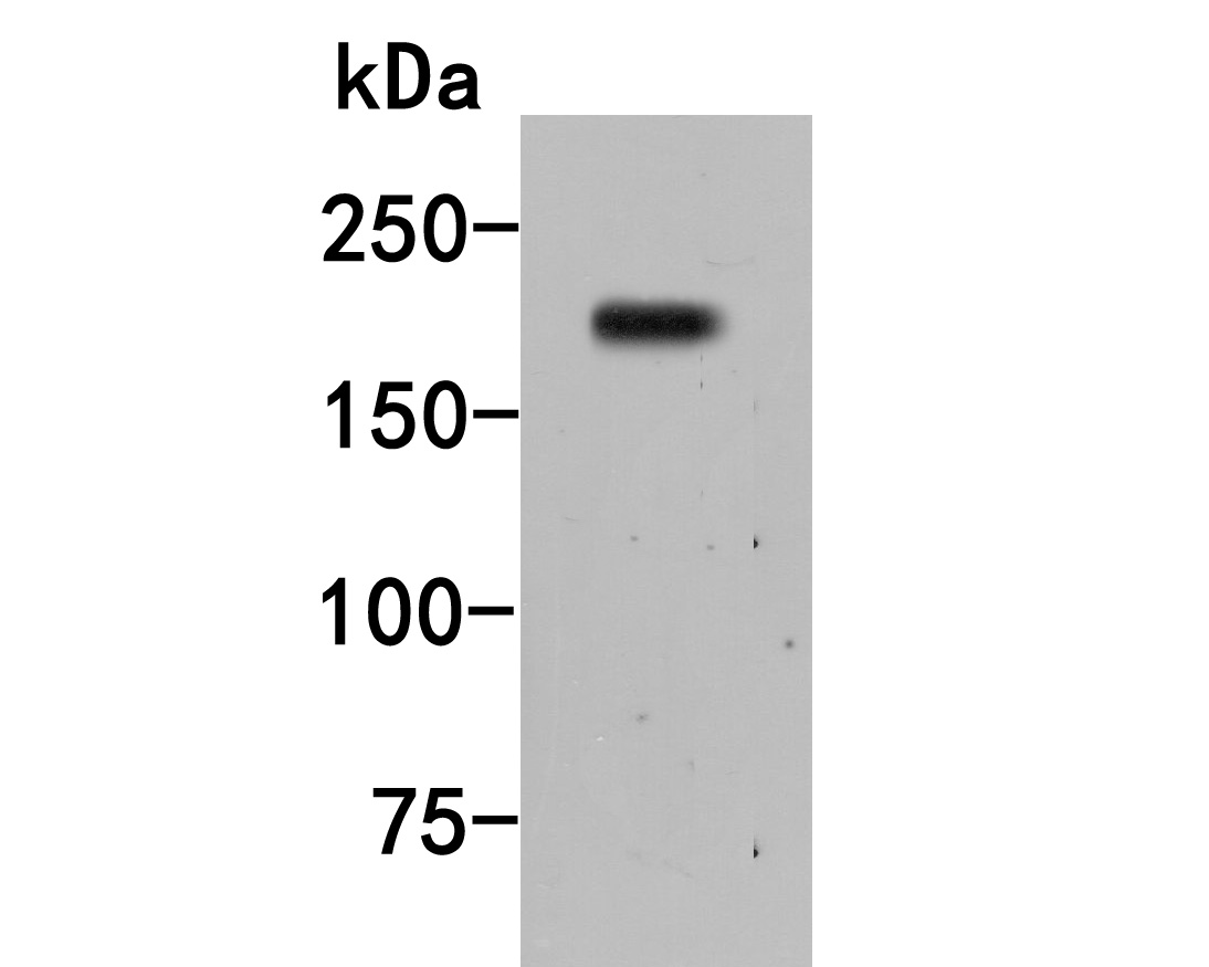Fig1:; Western blot analysis of Alpha-2-macroglobulin on LOVO cell lysate. Proteins were transferred to a PVDF membrane and blocked with 5% BSA in PBS for 1 hour at room temperature. The primary antibody ( 1/500) was used in 5% BSA at room temperature for 2 hours. Goat Anti-Rabbit IgG - HRP Secondary Antibody (HA1001) at 1:5,000 dilution was used for 1 hour at room temperature.