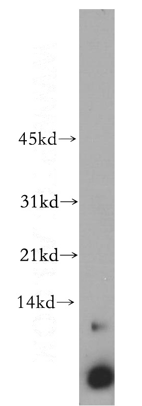 Jurkat cells were subjected to SDS PAGE followed by western blot with Catalog No:108662(C14orf2 antibody) at dilution of 1:500