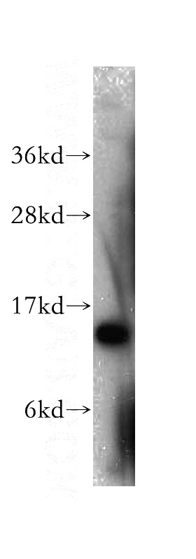HeLa cells were subjected to SDS PAGE followed by western blot with Catalog No:115414(SMA4 antibody) at dilution of 1:300