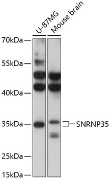 Western blot - SNRNP35 Polyclonal Antibody 