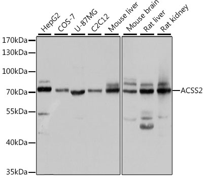 Western blot - ACSS2 Polyclonal Antibody 