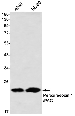 Western blot detection of Peroxiredoxin 1/PAG in A549,HL-60 using Peroxiredoxin 1/PAG Rabbit mAb(1:1000 diluted)