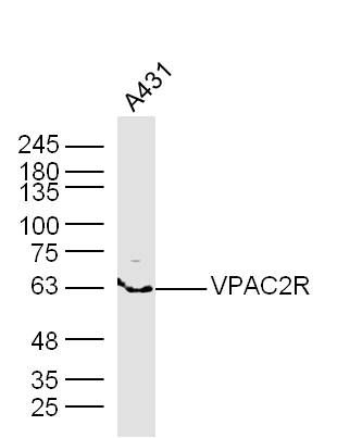 Fig1: Sample: A431 Cell Lysate at 40 ug; Primary: Anti- VPAC2R at 1/300 dilution; Secondary: IRDye800CW Goat Anti-Rabbit IgG at 1/20000 dilution; Predicted band size: 48 kD; Observed band size: 63 kD