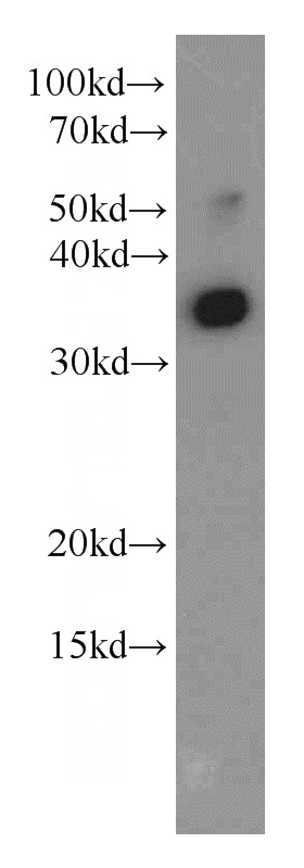 HeLa cells were subjected to SDS PAGE followed by western blot with Catalog No:112181(LDHA antibody) at dilution of 1:500