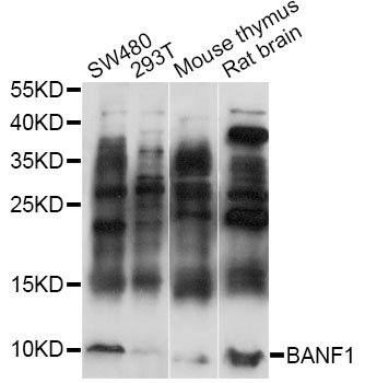 Western blot - BANF1 Polyclonal Antibody 