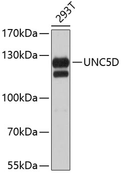 Western blot - UNC5D Polyclonal Antibody 
