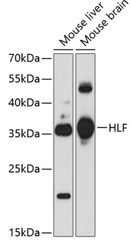 Western blot - HLF Polyclonal Antibody 