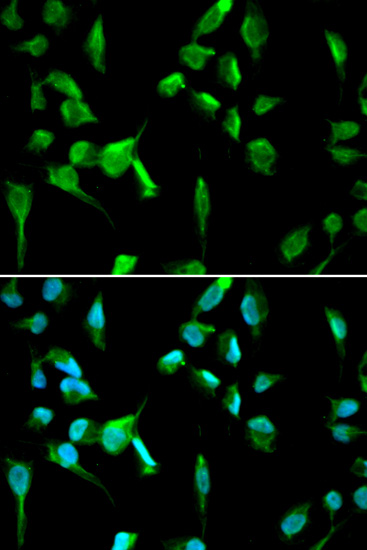 Immunofluorescence - TOPBP1 Polyclonal Antibody 