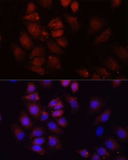 Immunofluorescence - HRNR Polyclonal Antibody 