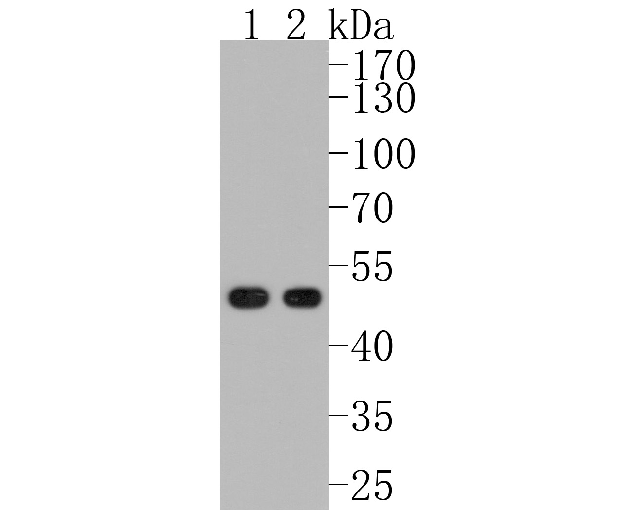 Fig1:; Western blot analysis of MEIS1 on different lysates. Proteins were transferred to a PVDF membrane and blocked with 5% BSA in PBS for 1 hour at room temperature. The primary antibody ( 1/500) was used in 5% BSA at room temperature for 2 hours. Goat Anti-Rabbit IgG - HRP Secondary Antibody (HA1001) at 1:200,000 dilution was used for 1 hour at room temperature.; Positive control:; Lane 1: Human skeletal muscle tissue lysate; Lane 2: Mouse brain tissue lysate