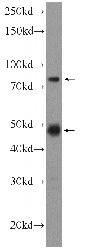 HL-60 cells were subjected to SDS PAGE followed by western blot with Catalog No:115132(SETMAR Antibody) at dilution of 1:600