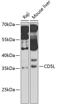 Western blot - CD5L Polyclonal Antibody 