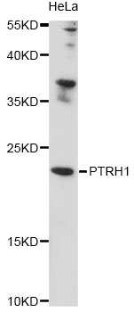 Western blot - PTRH1 Polyclonal Antibody 