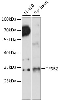 Western blot - TPSB2 Polyclonal Antibody 