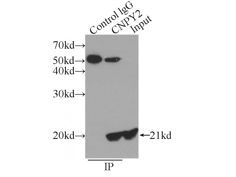 IP Result of anti-CNPY2,MSAP (IP:Catalog No:109356, 3ug; Detection:Catalog No:109356 1:500) with HepG2 cells lysate 600ug.
