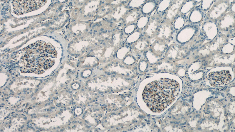 Immunohistochemistry of paraffin-embedded human kidney tissue slide using Catalog No:111417(HLA-A Antibody) at dilution of 1:50 (under 10x lens)