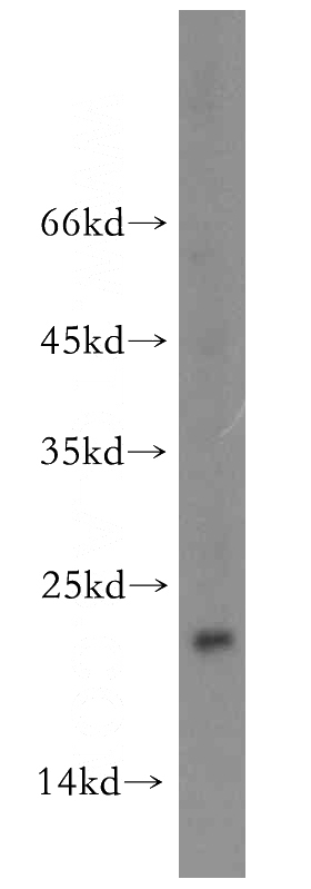 HeLa cells were subjected to SDS PAGE followed by western blot with Catalog No:113357(NUDT16 antibody) at dilution of 1:2500