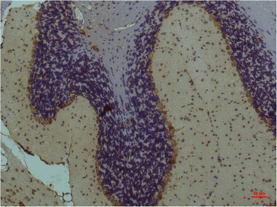 Immunohistochemical analysis of paraffin-embedded Mouse Brain Tissue using STAT3Mouse mAb diluted at 1:200.