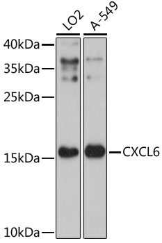 Western blot - CXCL6 Polyclonal Antibody 