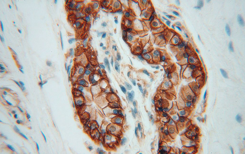 Immunohistochemical of paraffin-embedded human skin using Catalog No:108342(ATP1A2 antibody) at dilution of 1:100 (under 40x lens)