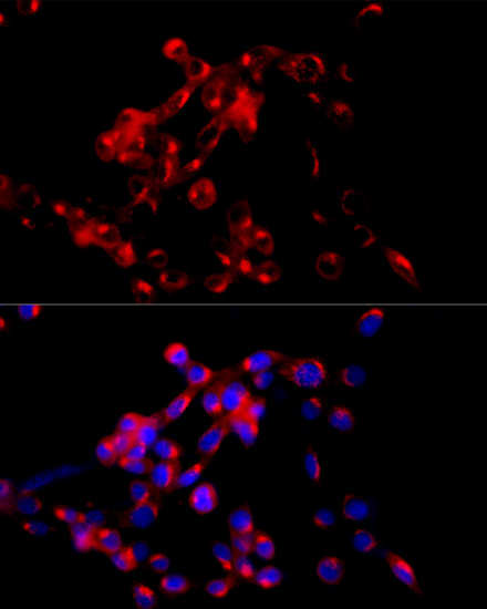 Immunofluorescence - COPB2 Polyclonal Antibody 