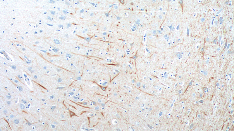 Immunohistochemistry of paraffin-embedded human brain tissue slide using Catalog No:107332(NEFL Antibody) at dilution of 1:200 (under 10x lens).