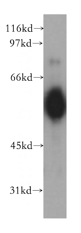Jurkat cells were subjected to SDS PAGE followed by western blot with Catalog No:109280(CHRNA5 antibody) at dilution of 1:500