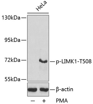Western blot - Phospho-LIMK1-T508 pAb 