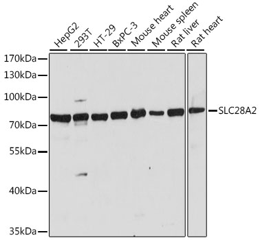 Western blot - SLC28A2 Polyclonal Antibody 