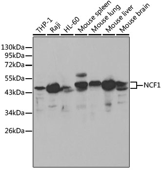 Western blot - NCF1 Polyclonal Antibody 