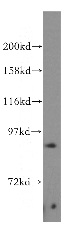 HeLa cells were subjected to SDS PAGE followed by western blot with Catalog No:113596(PARP9 antibody) at dilution of 1:500