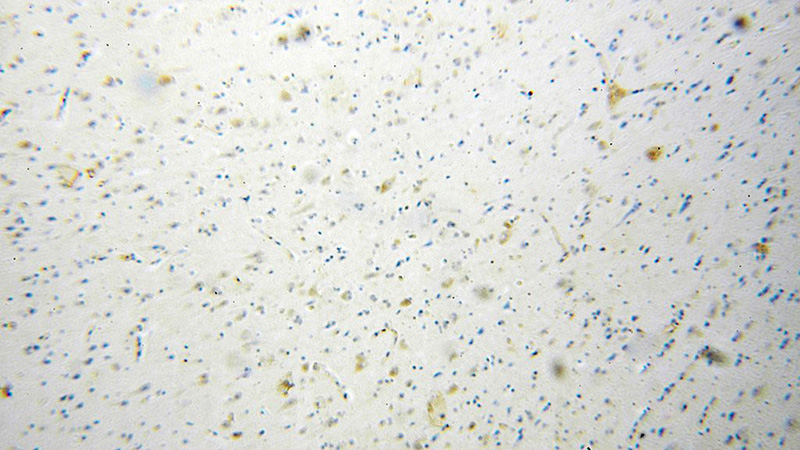 Immunohistochemical of paraffin-embedded human brain using Catalog No:108290(KIAA0652 antibody) at dilution of 1:100 (under 10x lens)