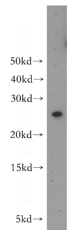 HEK-293 cells were subjected to SDS PAGE followed by western blot with Catalog No:112367(MAD2L1 antibody) at dilution of 1:800