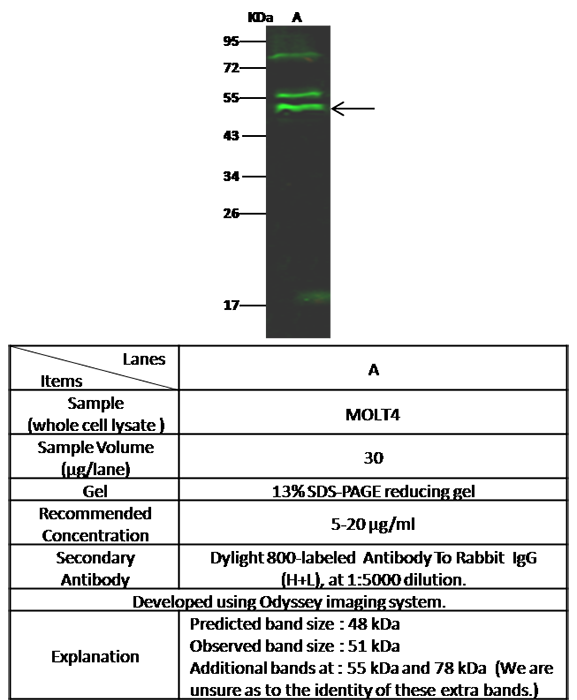 PTPN2 / TC-PTP Antibody, Rabbit PAb, Antigen Affinity Purified, Western blot
