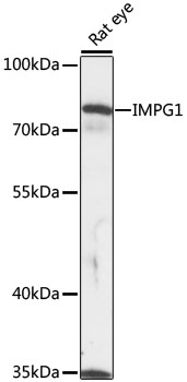 Western blot - IMPG1 Polyclonal Antibody 