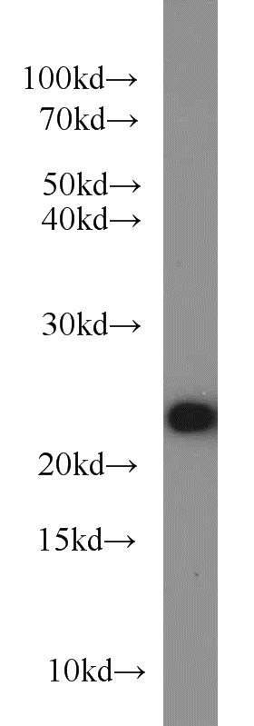mouse liver tissue were subjected to SDS PAGE followed by western blot with Catalog No:107746(ACOT6 antibody) at dilution of 1:1000