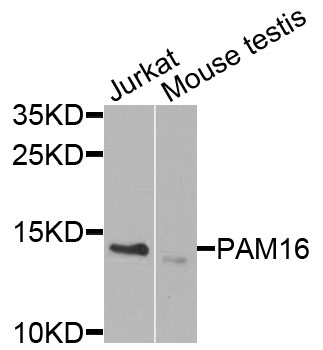 Western blot - PAM16 Polyclonal Antibody 