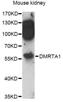 Western blot - DMRTA1 Polyclonal Antibody 
