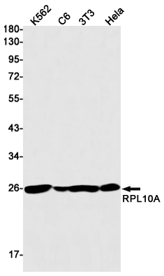 Western blot detection of RPL10A in K562,C6,3T3,Hela cell lysates using RPL10A Rabbit mAb(1:1000 diluted).Predicted band size:25kDa.Observed band size:25kDa.