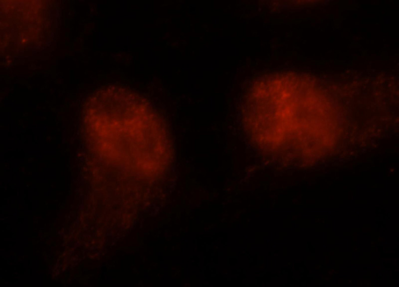 Immunofluorescent analysis of A2780 cells, using ANP32A antibody Catalog No:108104 at 1:25 dilution and Rhodamine-labeled goat anti-rabbit IgG (red).