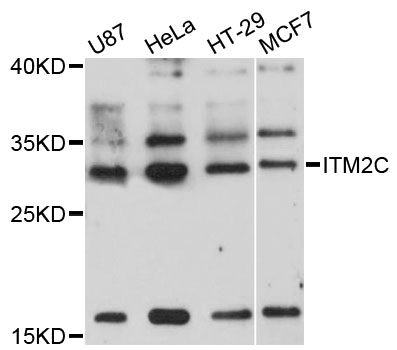 Western blot - ITM2C Polyclonal Antibody 