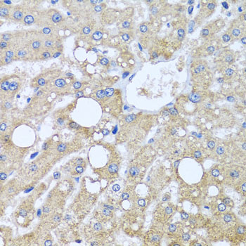 Immunohistochemistry - TUBGCP3 Polyclonal Antibody 